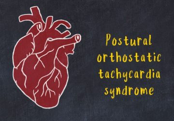 Tachicardia posturale ortostatica (POTS)